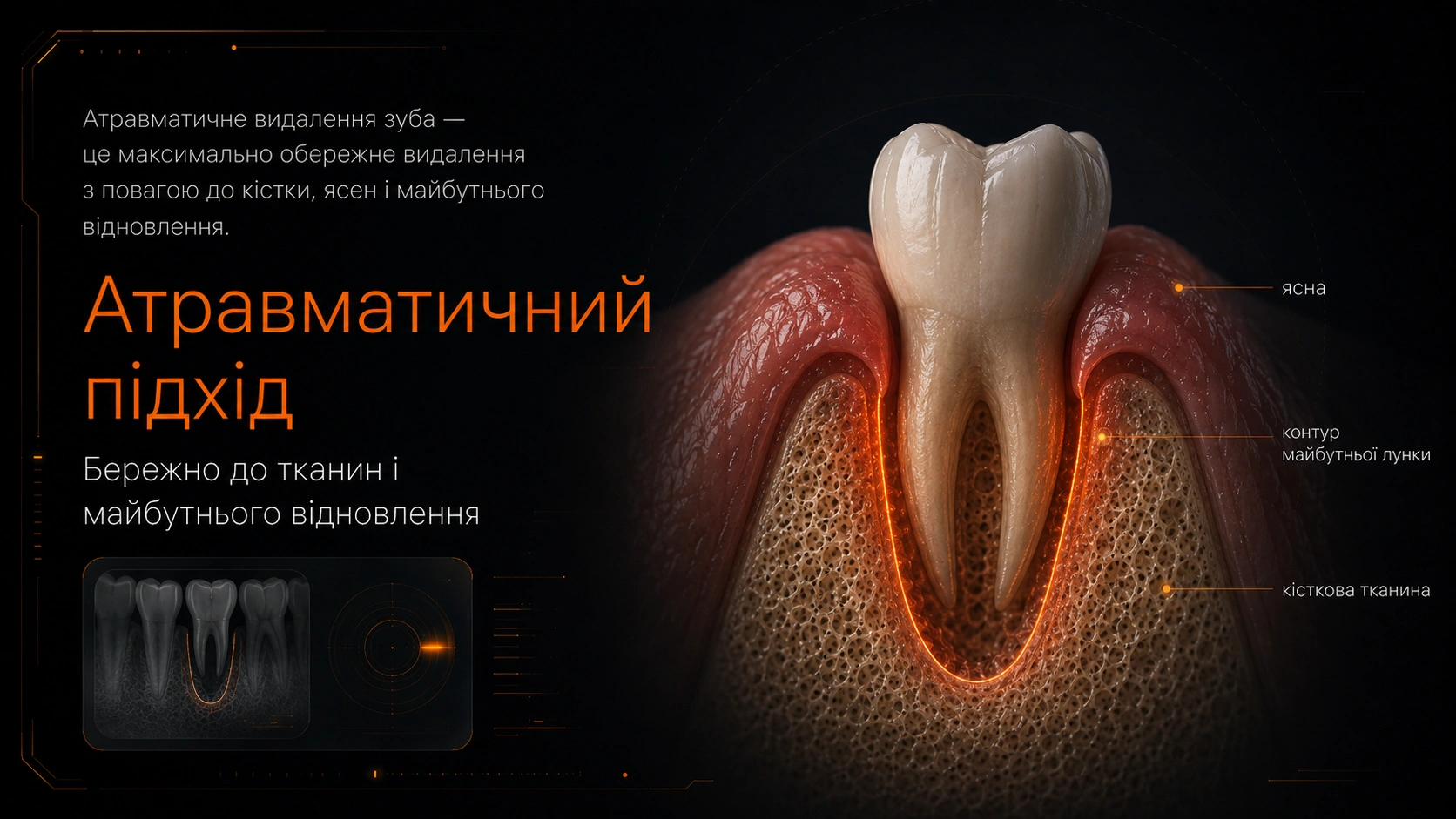 Цифрова візуалізація зуба, кісткової тканини та ясен перед атравматичним видаленням.