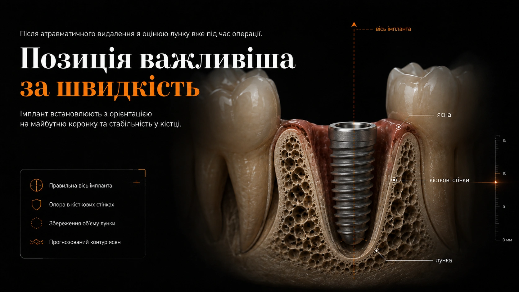 Схематична модель імплантата в лунці після контрольованого видалення зуба
