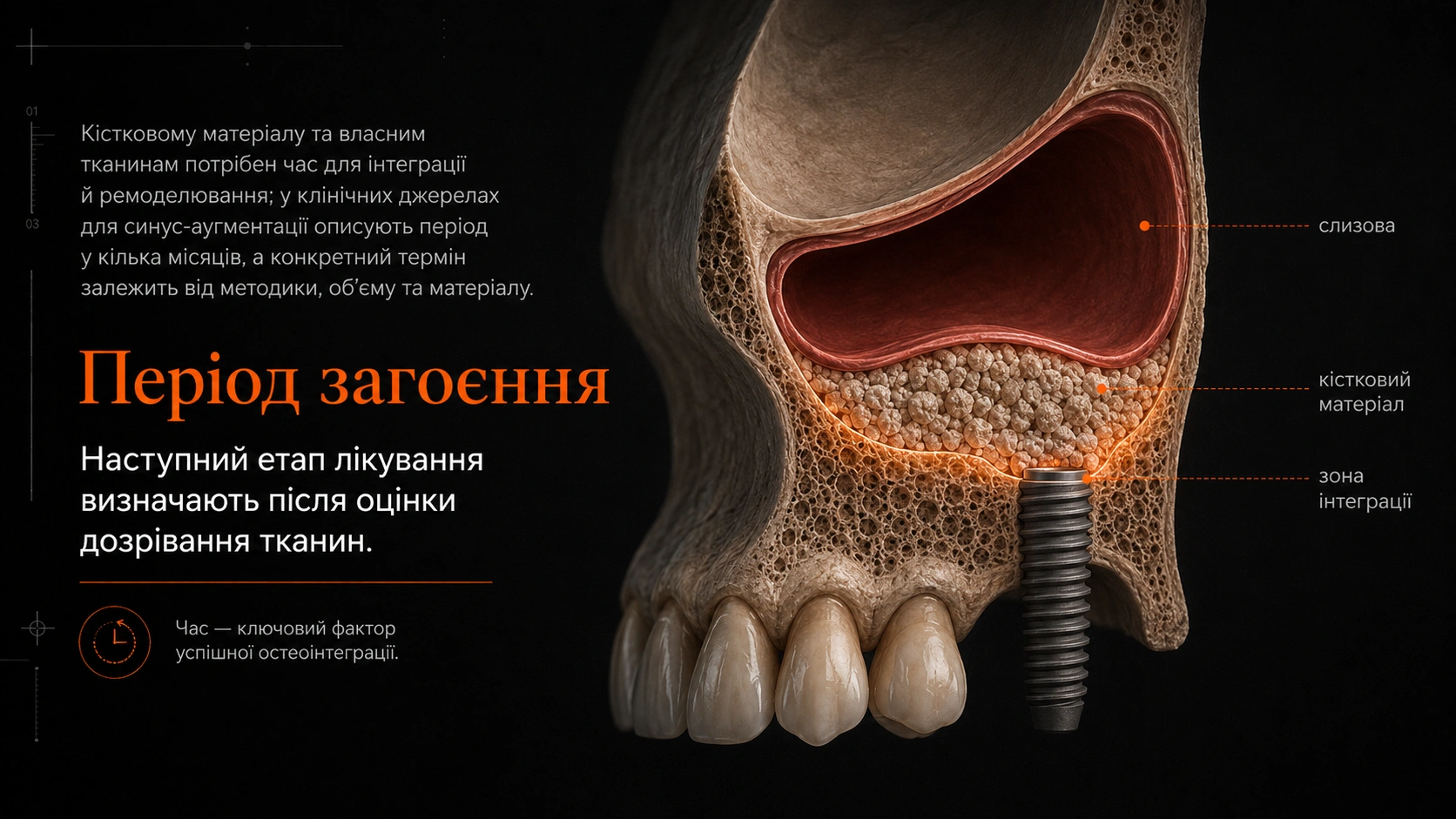 Схема відкритого та закритого доступу для підняття дна гайморової пазухи