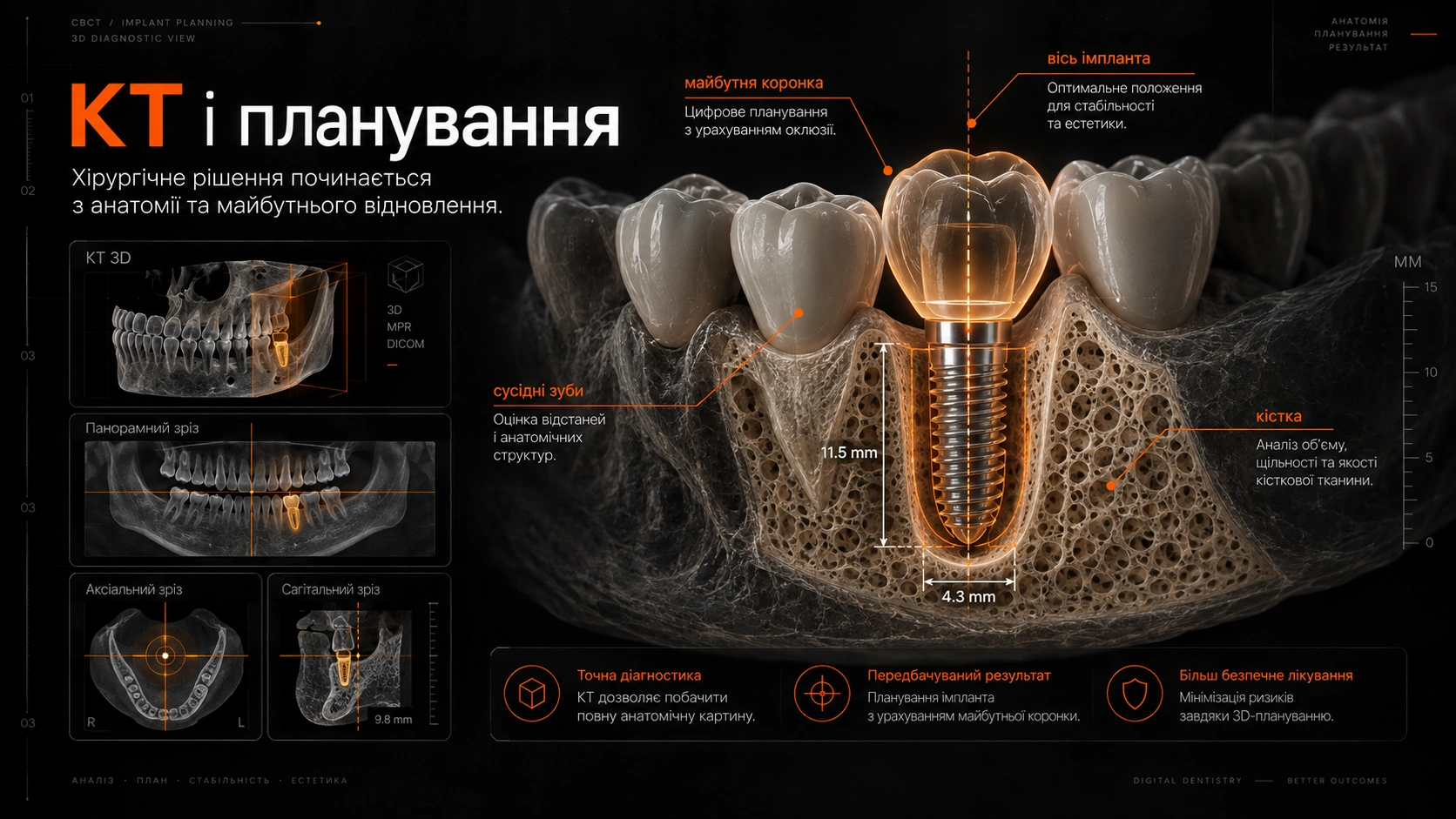 КТ і цифрове планування імплантації CBCT щелепи з цифровою траєкторією імплантата та анатомічною 3D-моделлю