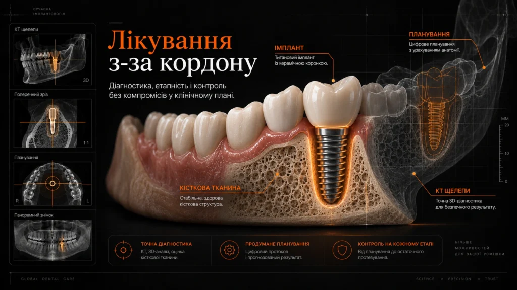 Імплантація в Ужгороді для пацієнтів з-за кордону