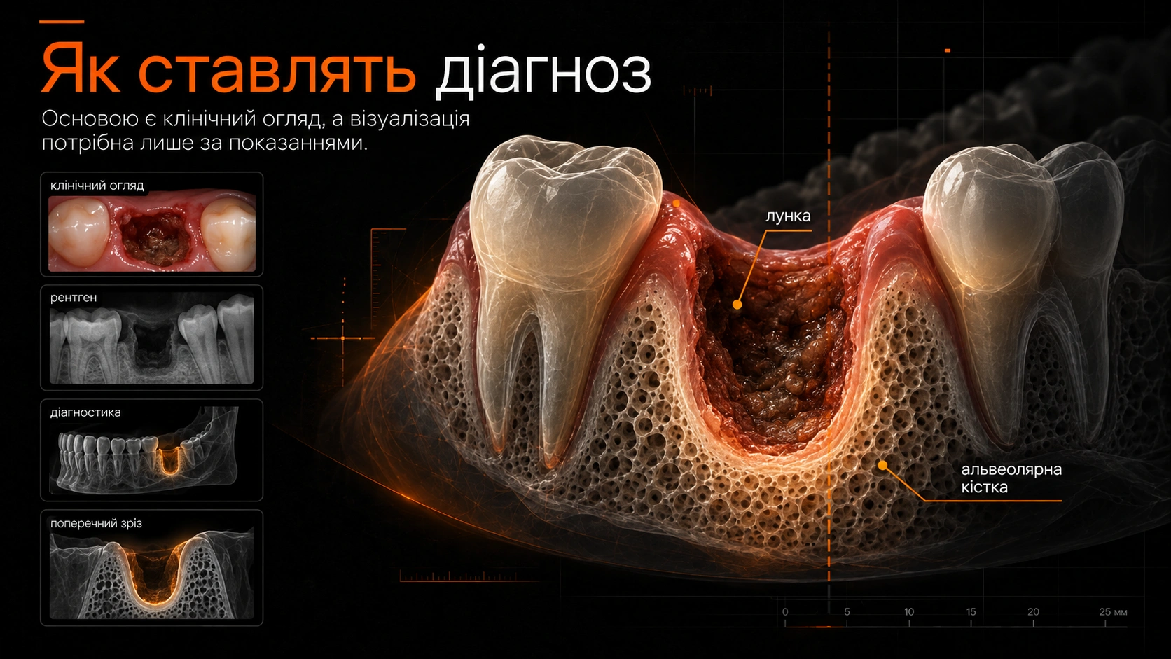 3D-модель лунки та стоматологічна рентген-візуалізація для оцінки причин болю після видалення зуба